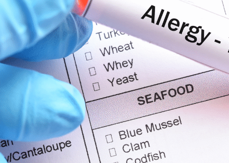 Allergy Testing Allergy Testing