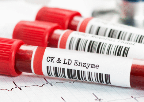 Blood Tests Blood Tests
