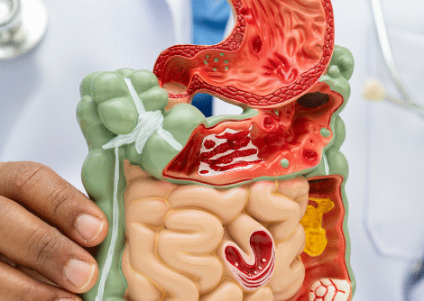Digestive Therapy Digestive Therapy