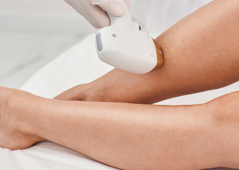 Hair Removal Hair Removal