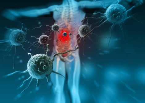 Immune Balance Immune Balance