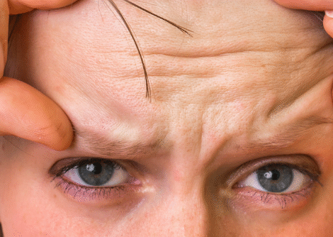 Wrinkle Reduction Wrinkle Reduction
